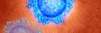 Coronavirus under the microscope