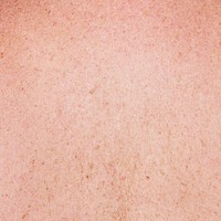 Light skin freckles complexion closeup shot