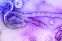 Electron microscopic image of Ebola virus.