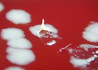 A petri dish culture plate contained a growth medium of sheep blood agar (SBA), which was inoculated with Bacillus anthracis bacteria.