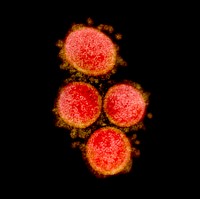 Novel Coronavirus SARS-CoV-2–Transmission electron micrograph of SARS-CoV-2 virus particles, isolated from a patient. Original image sourced from US Government department: The National Institute of Allergy and Infectious Diseases. Under US law this image is copyright free, please credit the government department whenever you can”.