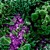 Novel Coronavirus SARS-CoV-2&ndash;Colorized scanning electron micrograph of an apoptotic cell (green) heavily infected with SARS-COV-2 virus particles (purple), isolated from a patient sample.