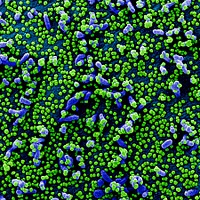 Novel Coronavirus SARS-CoV-2&ndash;Colorized scanning electron micrograph of a VERO E6 cell (blue) heavily infected with SARS-COV-2 virus particles (green), isolated from a patient sample.