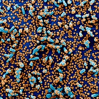 Novel Coronavirus SARS-CoV-2&ndash;Colorized scanning electron micrograph of a VERO E6 cell (blue) heavily infected with SARS-COV-2 virus particles (orange), isolated from a patient sample.