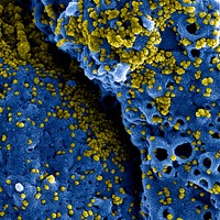 MERS Coronavirus Particles&ndash;Colorized scanning electron micrograph of MERS virus particles (yellow) both budding and attached to the surface of infected VERO E6 cells (blue). Original image sourced from US Government department: The National Institute of Allergy and Infectious Diseases. Under US law this image is copyright free, please credit the government department whenever you can&rdquo;.
