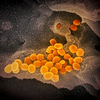 Novel Coronavirus SARS-CoV-2This scanning electron microscope image shows SARS-CoV-2 (orange)&mdash;also known as 2019-nCoV, the virus that causes COVID-19&mdash;isolated from a patient in the U.S., emerging from the surface of cells (gray) cultured in the lab.