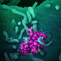 Novel Coronavirus SARS-CoV-2–This scanning electron microscope image shows SARS-CoV-2 (round magenta objects) emerging from the surface of cells cultured in the lab.