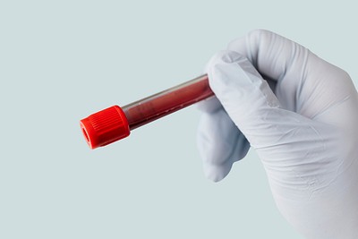 Doctor Holding A Blood Test Free Png Sticker Rawpixel
