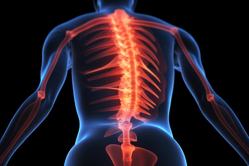 Back Pain Images  Free Photos, PNG Stickers, Wallpapers