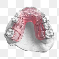 Orthodontic retainer png sticker, transparent background