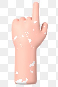 Finger-pointing hand png gesture, vitiligo awareness, 3D illustration, transparent background