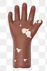 Raised vitiligo hand png gesture, 3D illustration, transparent background