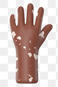 Raised vitiligo hand png gesture, 3D illustration, transparent background