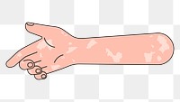 PNG Reaching vitiligo hand, gesture illustration, transparent background