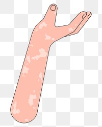 PNG Vitiligo presenting hand, gesture flat illustration, transparent background