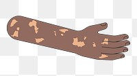 PNG Black vitiligo hand, body part flat illustration, transparent background