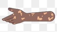 PNG Reaching vitiligo hand, gesture illustration, transparent background