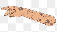 PNG Vitiligo arm hand, body part flat illustration, transparent background