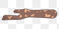 PNG Vitiligo helping hand gesture, flat illustration, transparent background