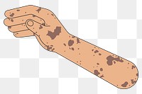 PNG Vitiligo hand arm, gesture flat illustration, transparent background