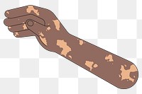 PNG Black vitiligo hand arm, gesture flat illustration, transparent background