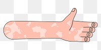 PNG Vitiligo palm hand, gesture flat illustration, transparent background