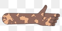 PNG Vitiligo palm hand, gesture flat illustration, transparent background