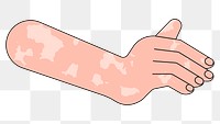 PNG White vitiligo hand gesture, flat illustration, transparent background