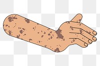 PNG Tanned vitiligo hand gesture, flat illustration, transparent background