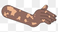 PNG Black vitiligo hand gesture, flat illustration, transparent background