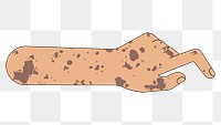 PNG Tanned vitiligo hand gesture, flat illustration, transparent background