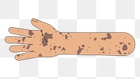 PNG Tanned vitiligo hand arm, gesture illustration, transparent background