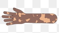 PNG Black vitiligo hand arm, gesture illustration, transparent background