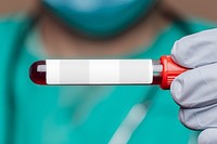 Surgeon holding a blood test tube transparent png 