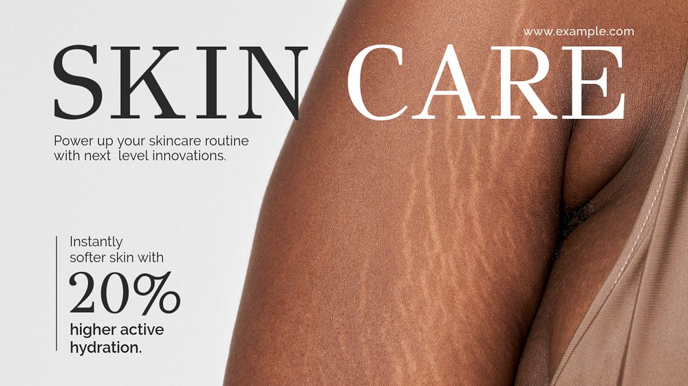Body positivity YouTube thumbnail template, stretch marks photo