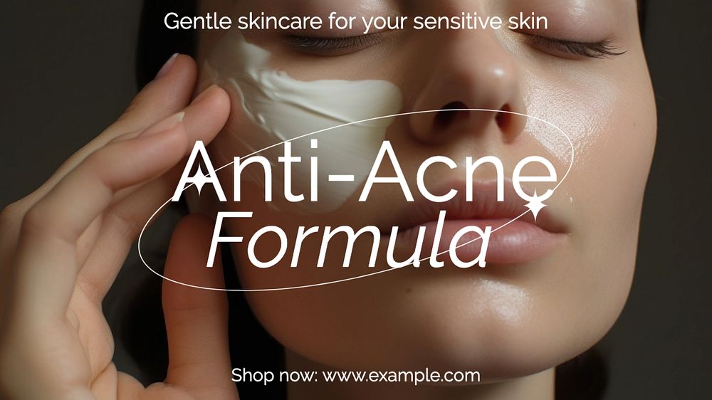 Anti-acne skincare blog banner template, editable text