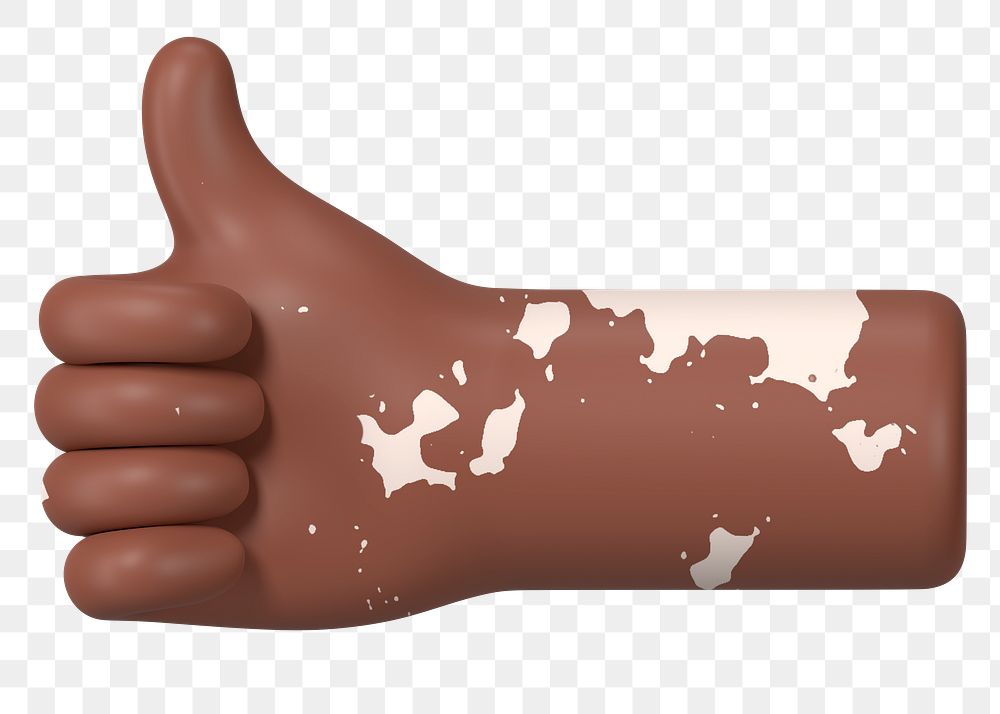 Thumbs up hand png gesture, vitiligo awareness, 3D illustration, transparent background