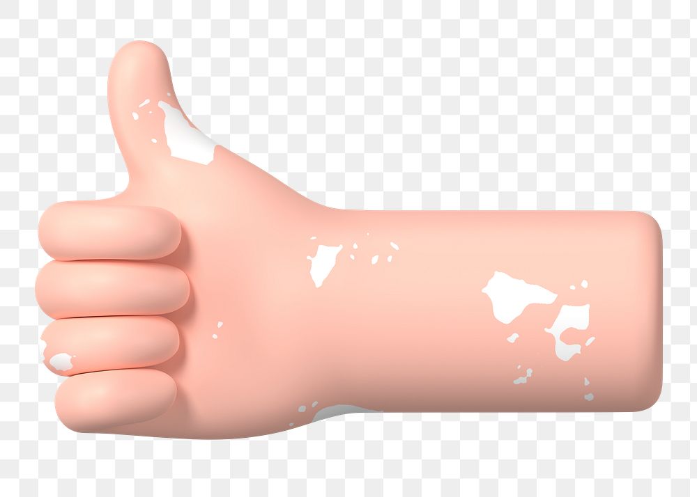 Thumbs up hand png gesture, vitiligo awareness, 3D illustration, transparent background