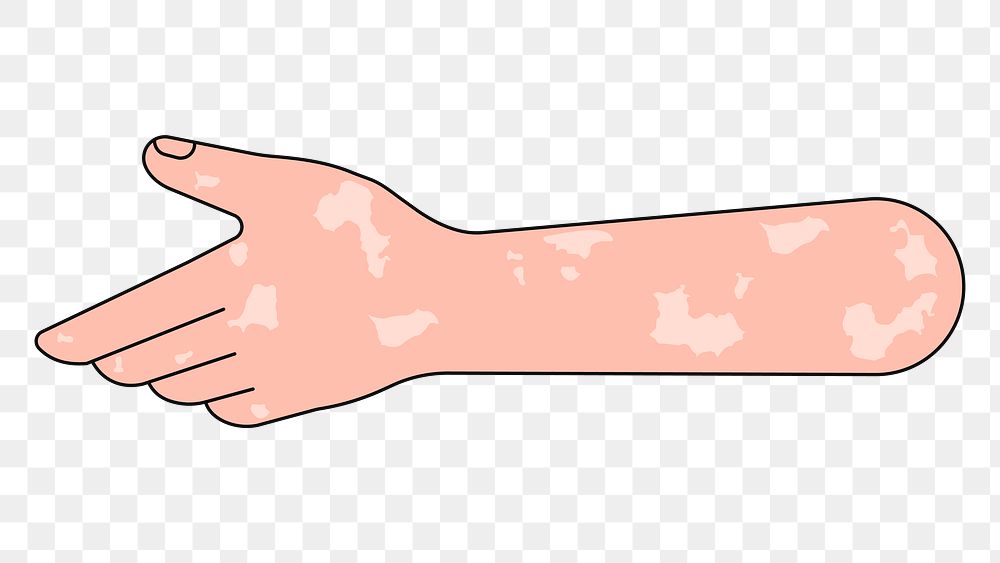 PNG Reaching vitiligo hand, gesture illustration, transparent background