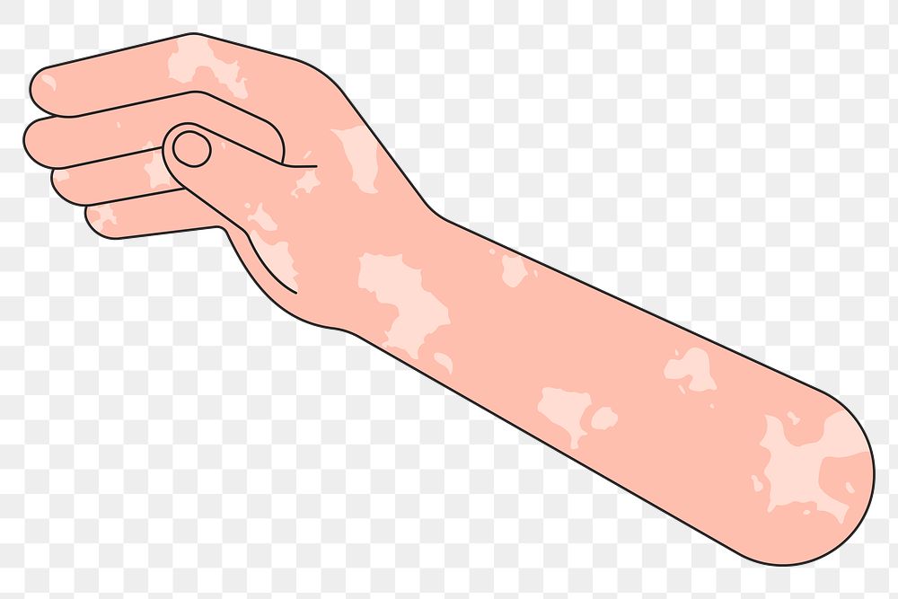 PNG Vitiligo hand arm, gesture flat illustration, transparent background