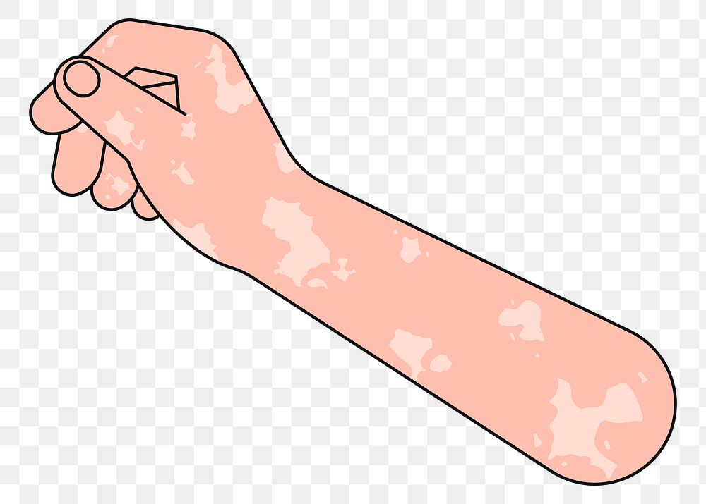 PNG Vitiligo hand arm, gesture flat illustration, transparent background