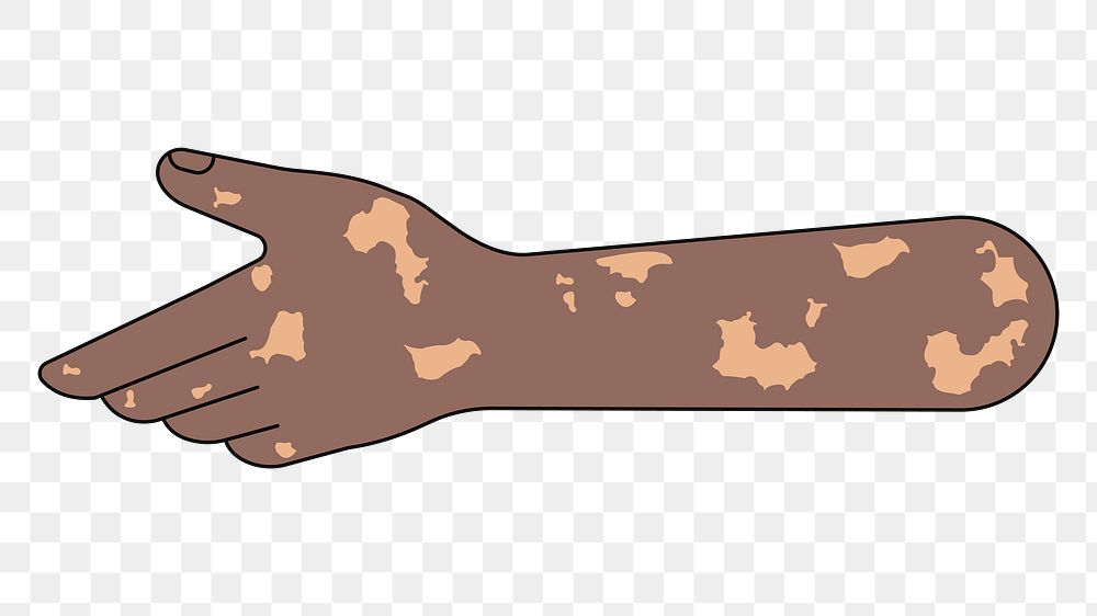 PNG Reaching vitiligo hand, gesture illustration, transparent background