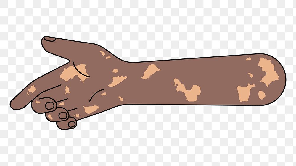 PNG Reaching vitiligo hand, gesture illustration, transparent background