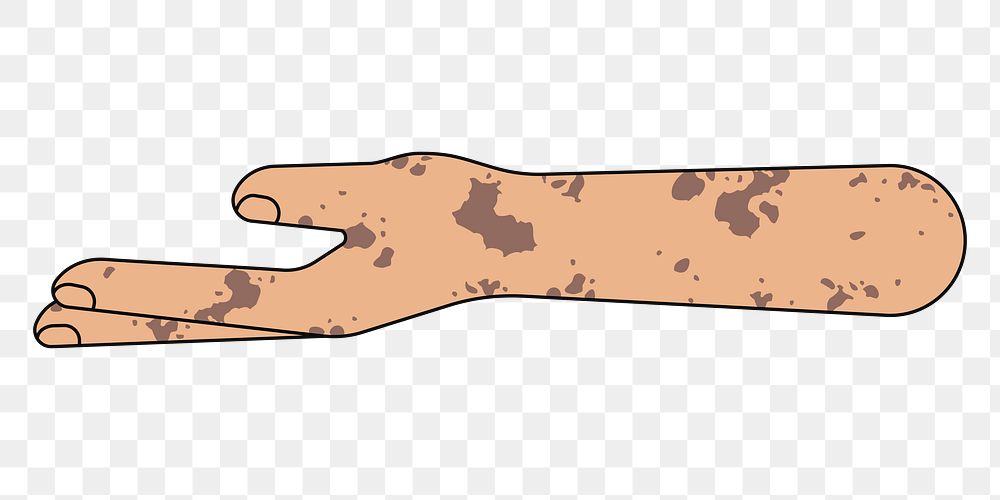 PNG Vitiligo helping hand gesture, flat illustration, transparent background