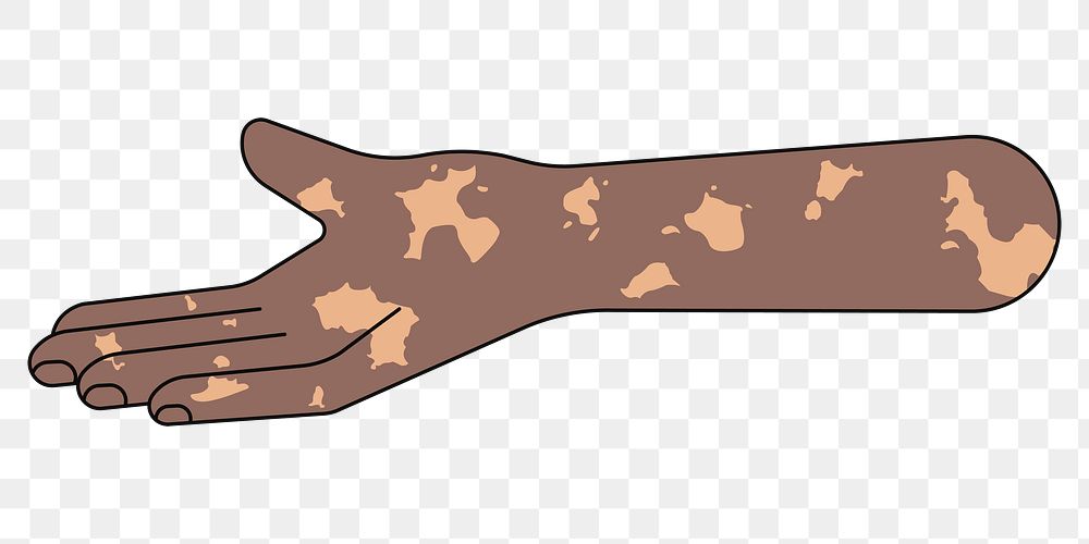 PNG Vitiligo helping hand gesture, flat illustration, transparent background