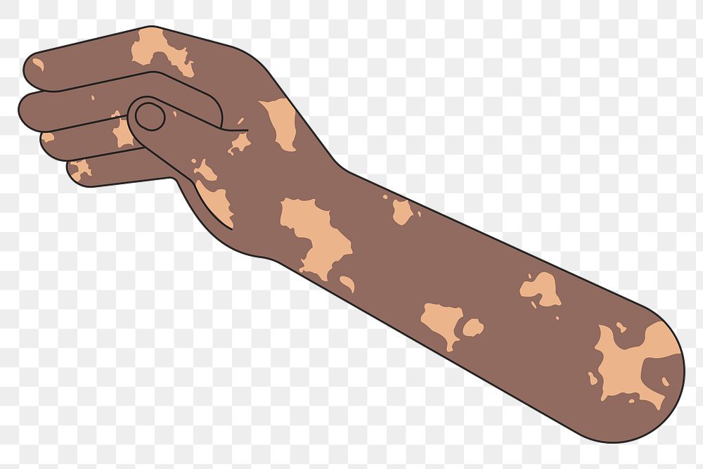 PNG Black vitiligo hand arm, gesture flat illustration, transparent background