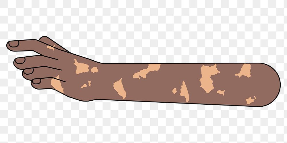 PNG Vitiligo hand reaching out, gesture illustration, transparent background