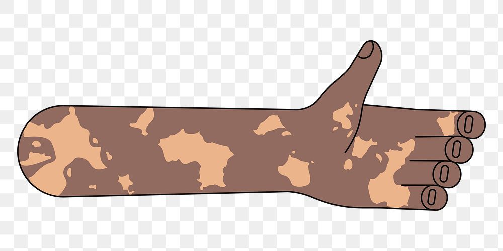 PNG Vitiligo palm hand, gesture flat illustration, transparent background