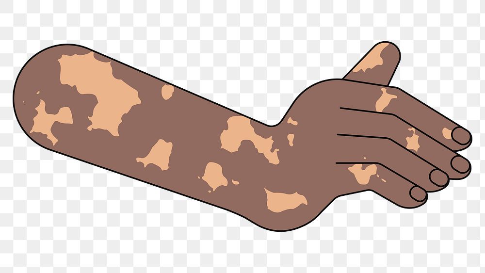 PNG Black vitiligo hand gesture, flat illustration, transparent background