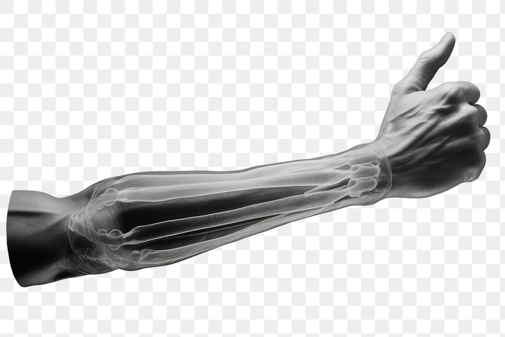 PNG Arm muscle x-ray finger hand. AI generated Image by rawpixel.